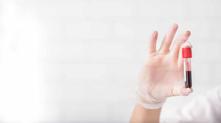 Welt-CML-Tag Welt-CML-Tag
