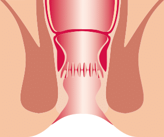Normale Hämorrhoiden