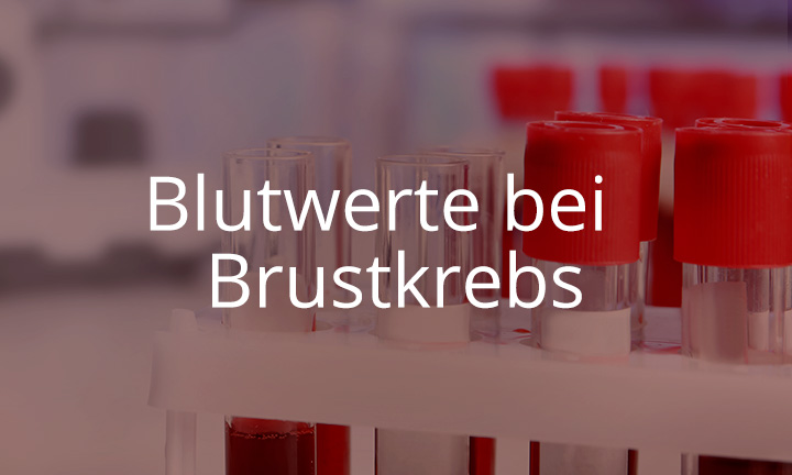 Blutwerte bei Brustkrebs Blutwerte bei Brustkrebs