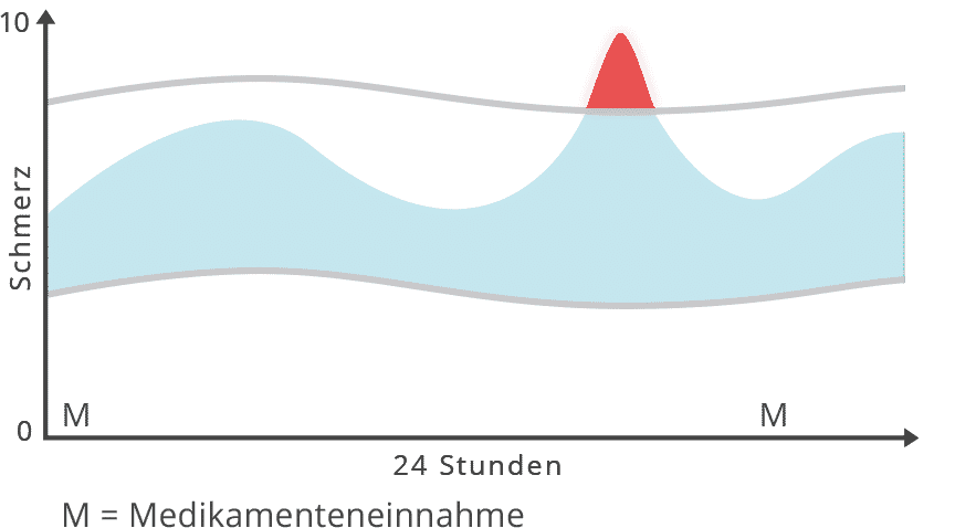 Diagramm Durchbruchschmerzen