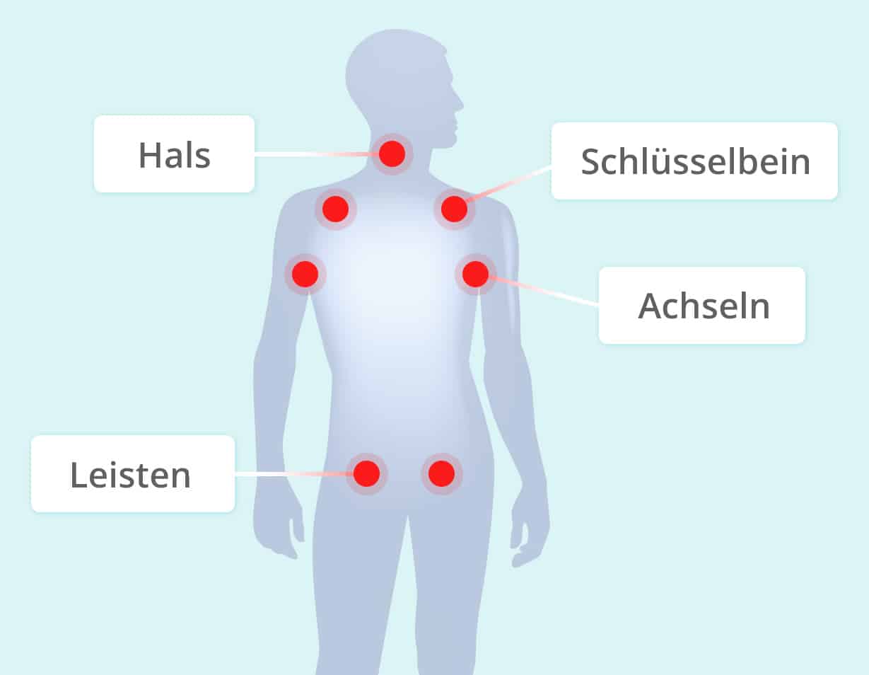 Lymphknotenschwellungen Koerperregionen