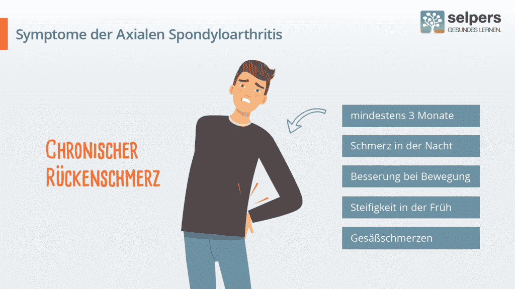 Chronischer Rückenschmerz als Symptom der axialen Spondyloarthritis