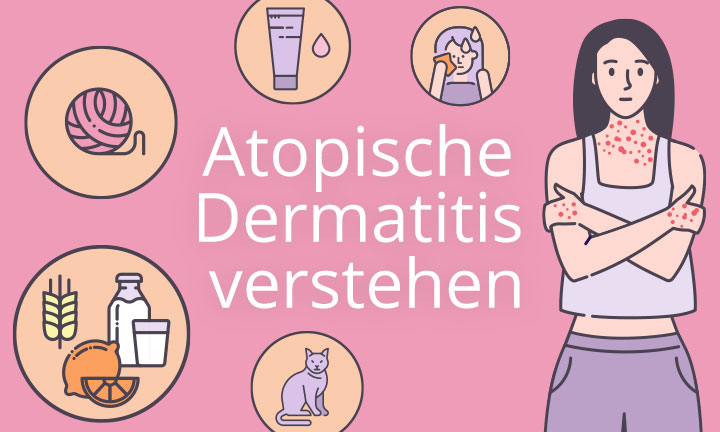 AtopischeDermatitisVerstehen_Kursbild_L3 Atopische Dermatitis verstehen