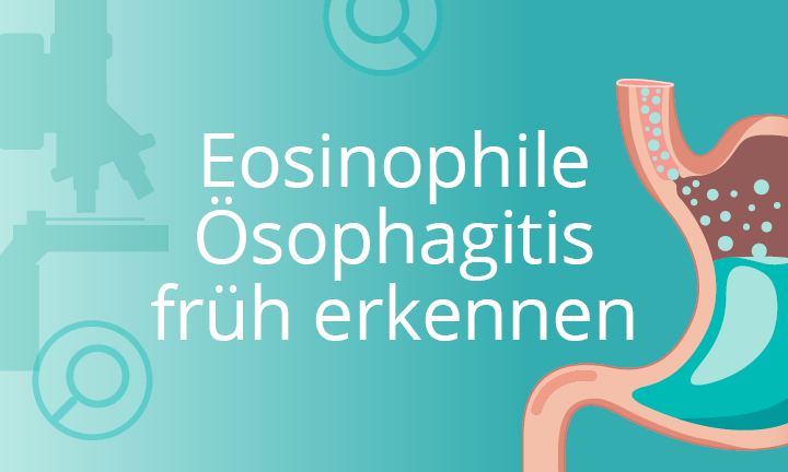 Kursbild_EoE_verstehen Eosinophile Ösophagitis früh erkennen
