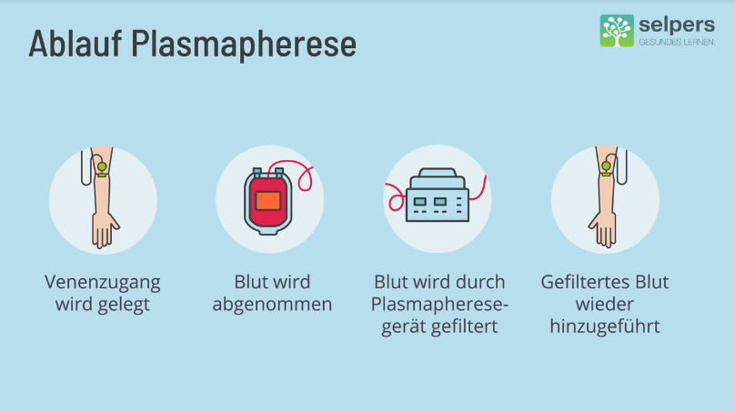 ablauf-einer-plasmapherese-selpers-2 Ablauf der Plasmapherese - Morbus Waldenström
