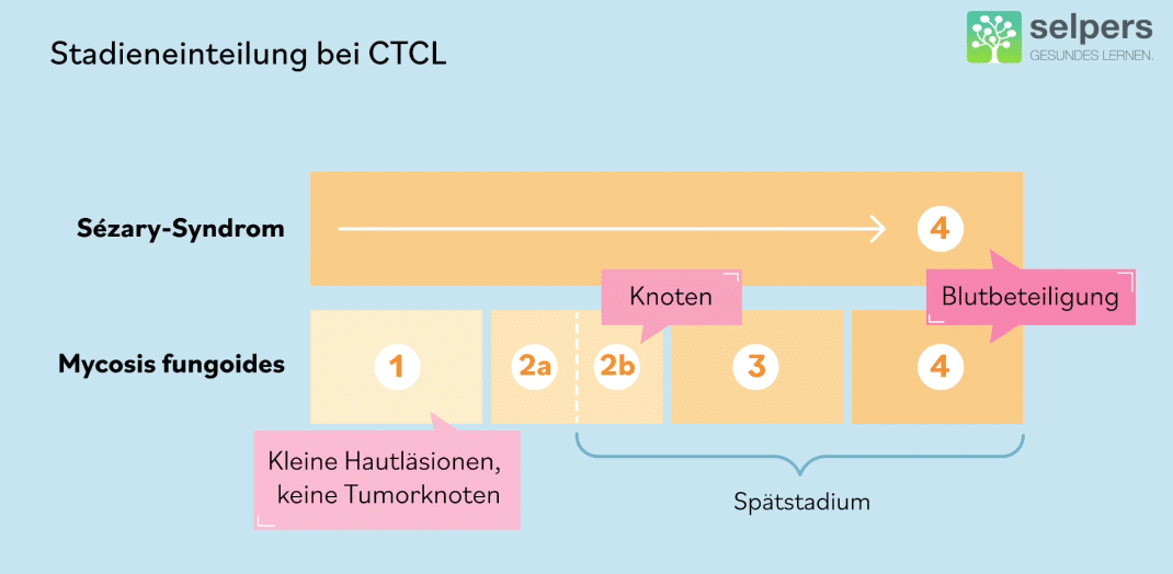 Stadieneinteilung_CTCLverstehen