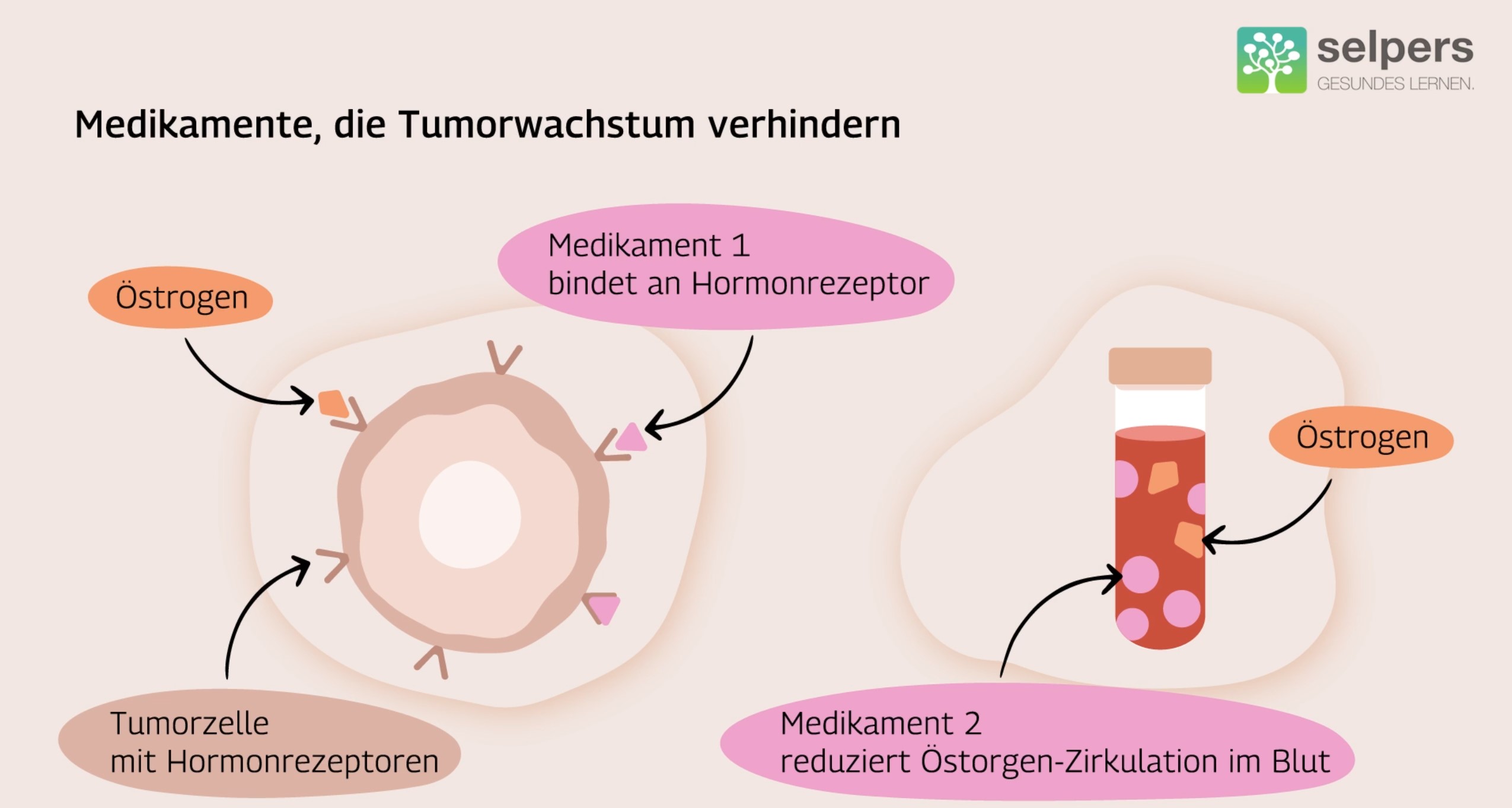 Therapieansätze bei hormonrezeptor-positivem Brustkrebs Therapieansätze bei hormonrezeptor-positivem Brustkrebs