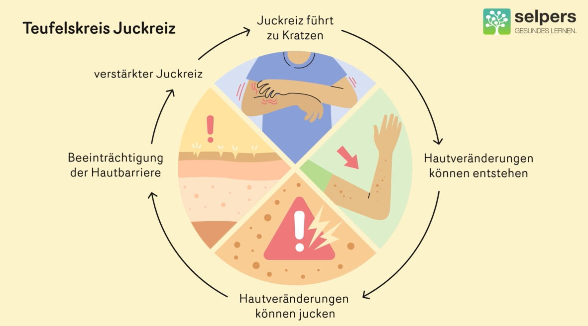 Teufelskreis-Juckreiz-Dialyse-und-Juckreiz